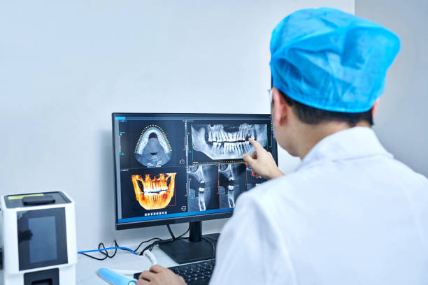 Best Emergency Dentist for Lost Fillings or Crowns in Bertville, AL